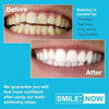 Teeth Whitening Strips - Zero Peroxide - Fluoride Free - Whiten Teeth - Enamel Safe! Promising Shades Whiter for That Whiter Smile You're After!
